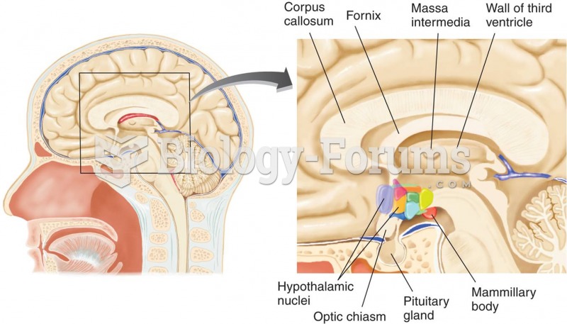 A Midsagittal View of Part of the Brain