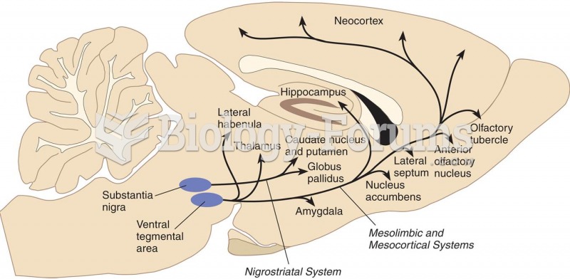 Dopaminergic Pathways in a Rat Brain 