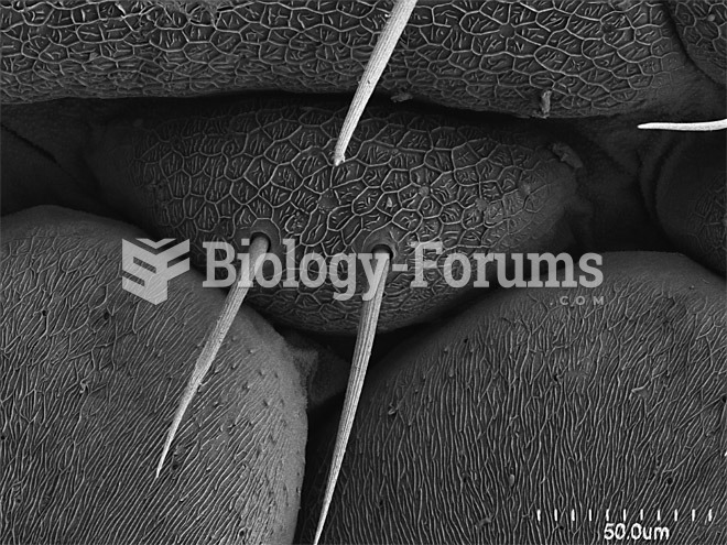 Scorpions, Spiders and Sharks: Electron-Microscope Images