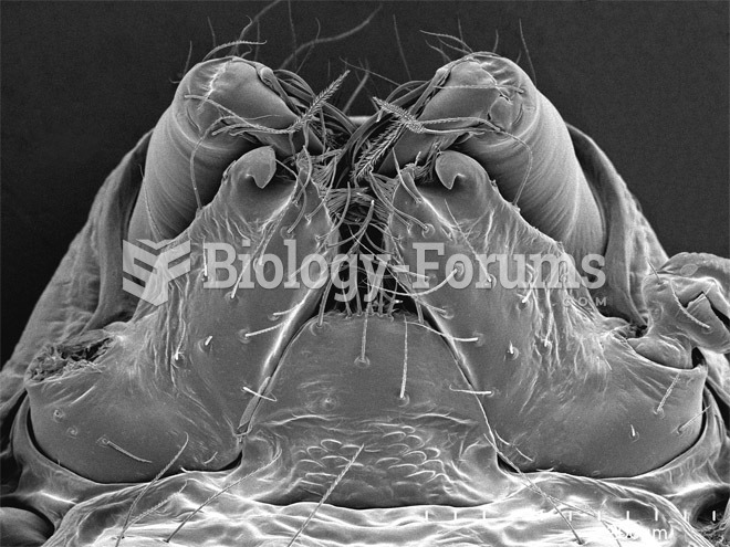 Scorpions, Spiders and Sharks: Electron-Microscope Images