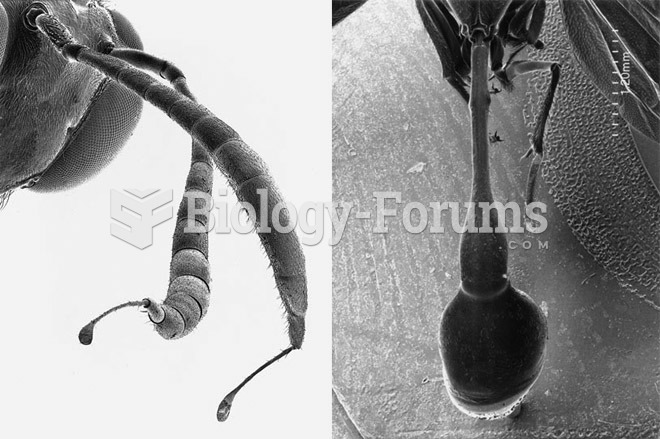 Scorpions, Spiders and Sharks: Electron-Microscope Images