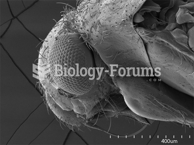 Scorpions, Spiders and Sharks: Electron-Microscope Images