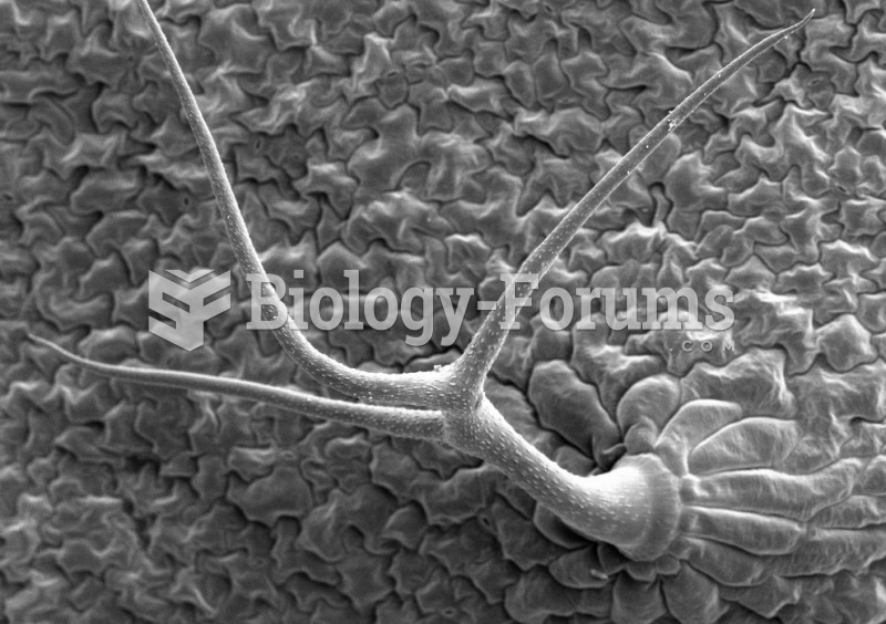 lower surface of Arabidopsis thaliana leaf, showing a trichome