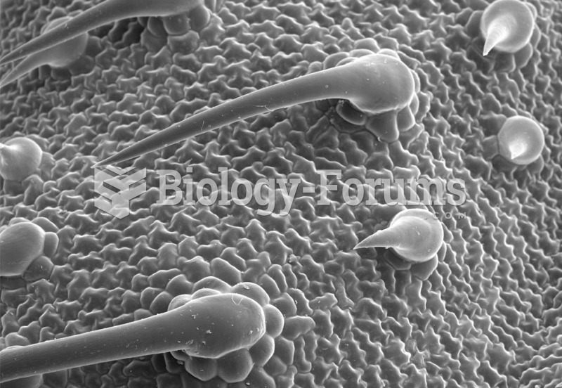 Heliotropium (marine heliotrope) lower leaf surface, showing trichomes and a few stomata