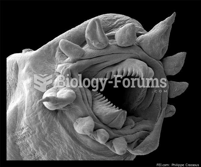 Hydrothermal Worm Viewed Under An Electron Microscope