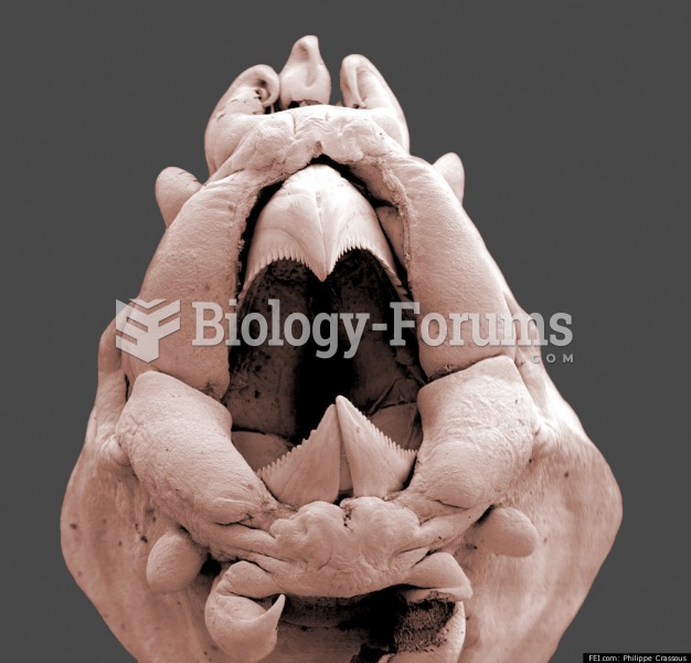 Marine Worm Under An Electron Microscope