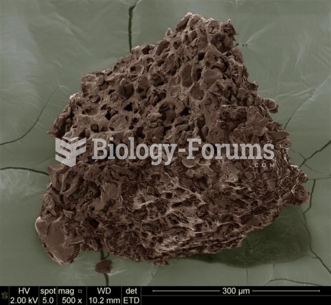 Ground coffee magnified