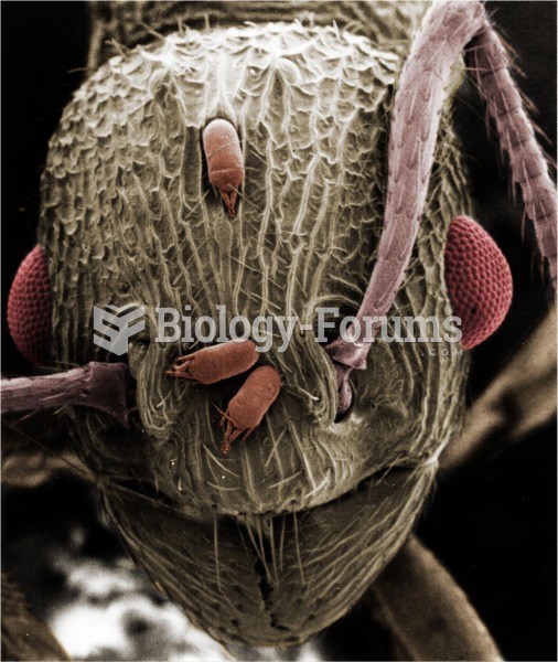 An ant under an electron microscope