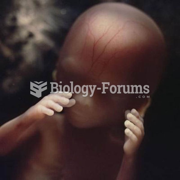 16 weeks old human fetus