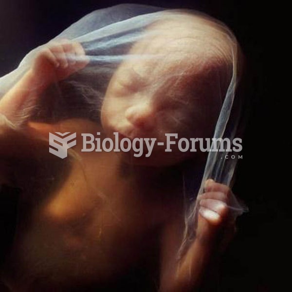 18 weeks old  human fetus