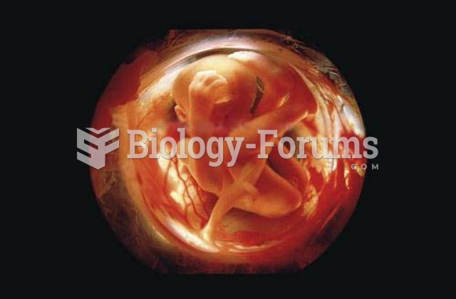 24 weeks old  human fetus