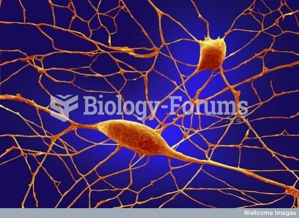 Purkinje neurons