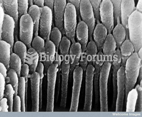 stereocilia inside the ear