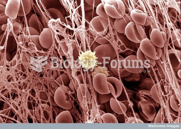 Reb blood cells get caught up in the sticky web of a blood clot