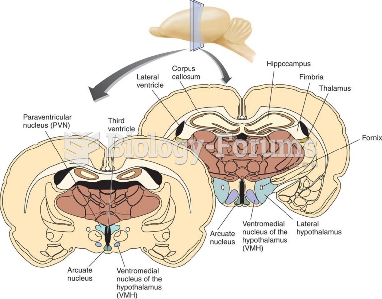 Regions of the Hypothalamus Involved in Eating and Metabolism 