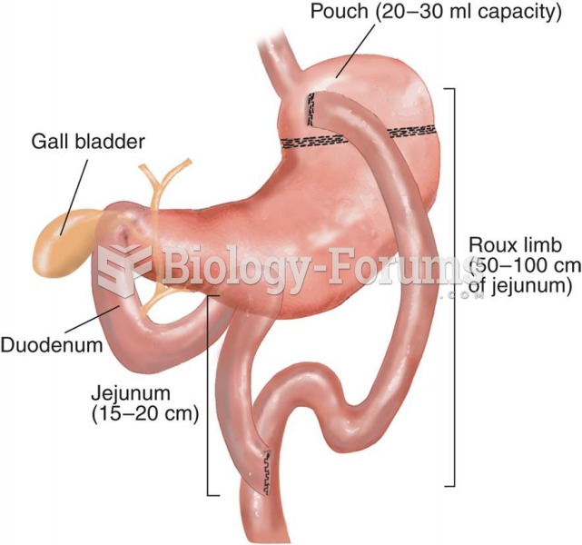 Roux-en-Y Gastric Bypass (RYGB) Surgery 