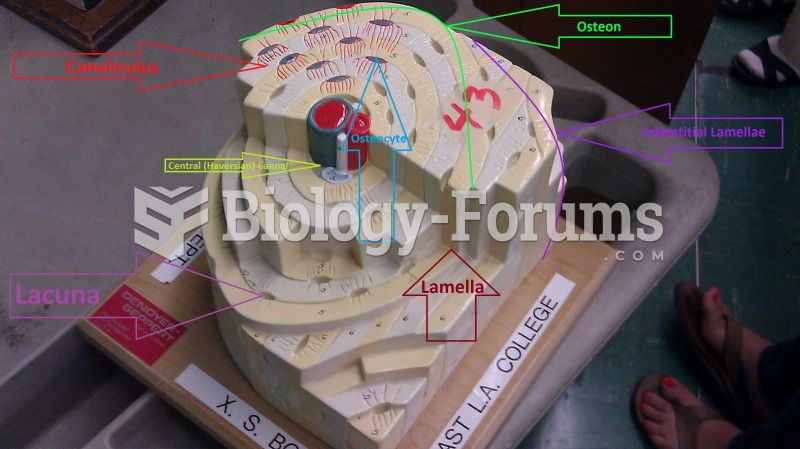 Osteon model labeled