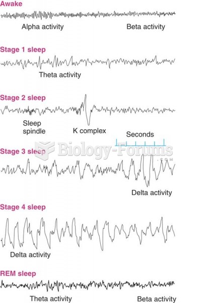 An EEG Recording of the Stages of Sleep