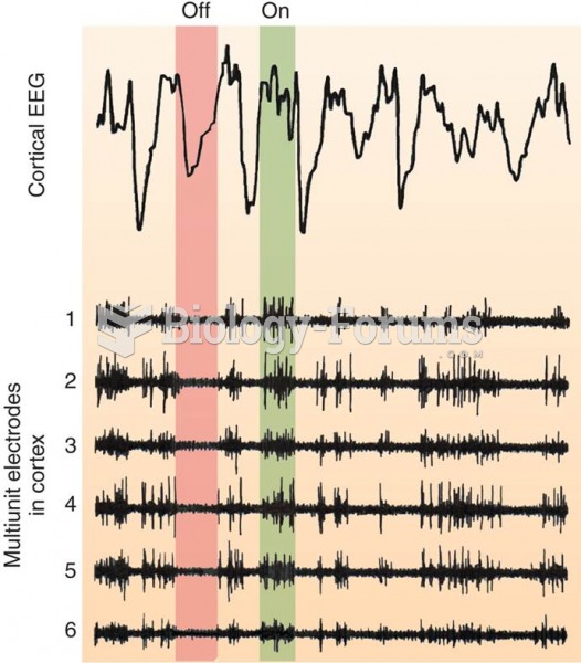 EEG and Single-Cell Activity 