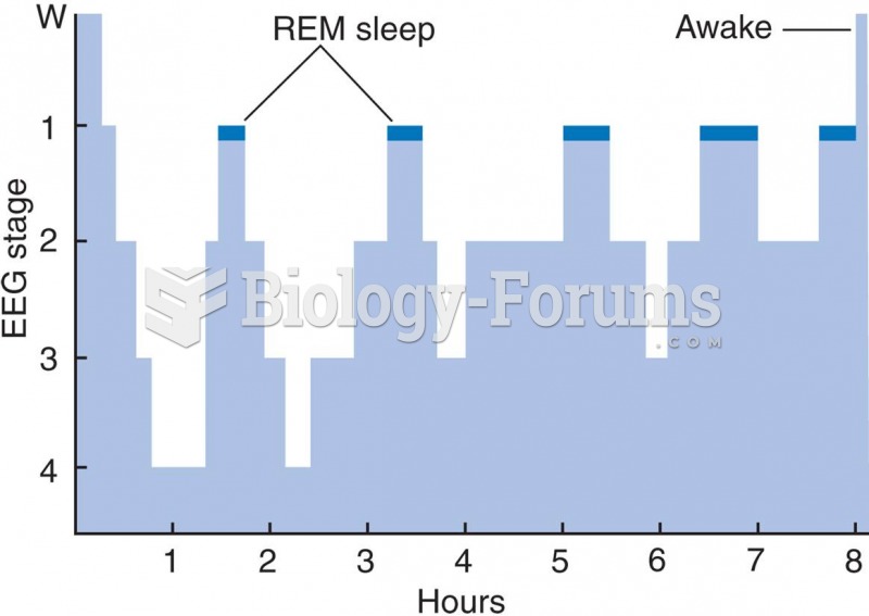 A Typical Pattern of Sleep Stages During a Single Night  