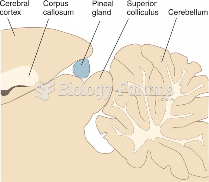 Pineal Gland, Located on the Dorsal Surface of the Midbrain 