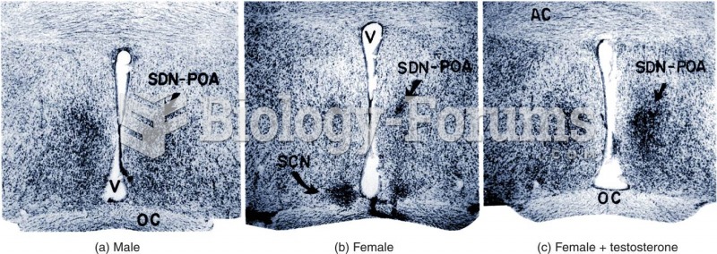 Preoptic Area of the Rat Brain 