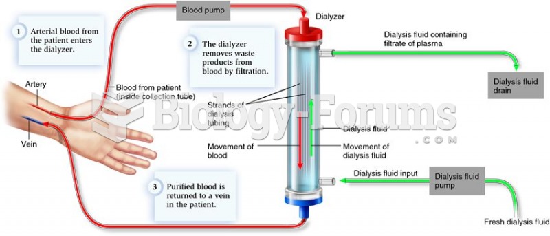 Simplified diagram of hemodialysis.