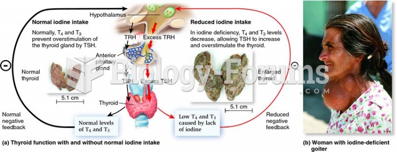 Consequences of normal and inadequate iodine in the diet.