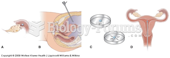 Steps involved in in vitro fertilization. 