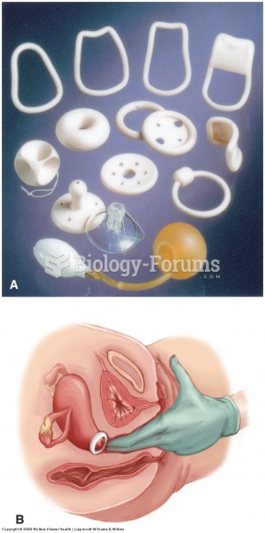 Examples of pessaries. (A) Various shapes and sizes of pessaries available. (B) Insertion of one typ