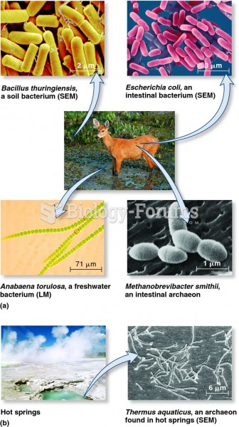 A comparison of selected species of bacteria and archaea.