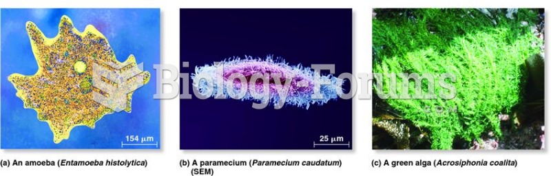 Examples of protists.