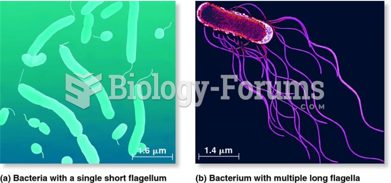 Differences in the number and location of flagella.