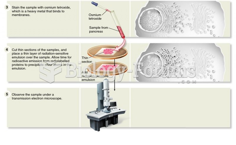 Palade's use of the pulse-chase method to study protein secretion