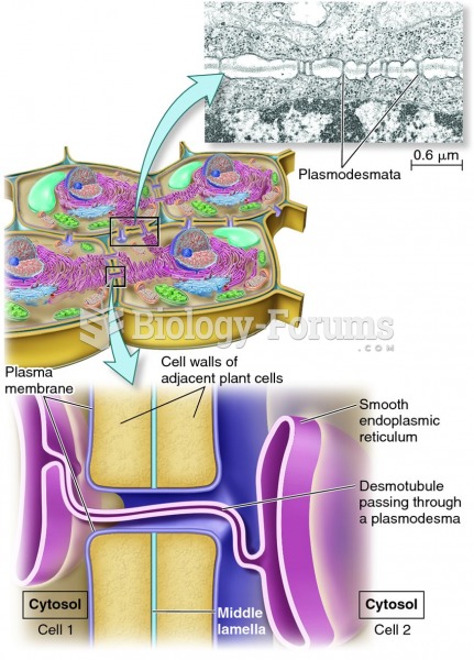 Structure of plasmodesmata