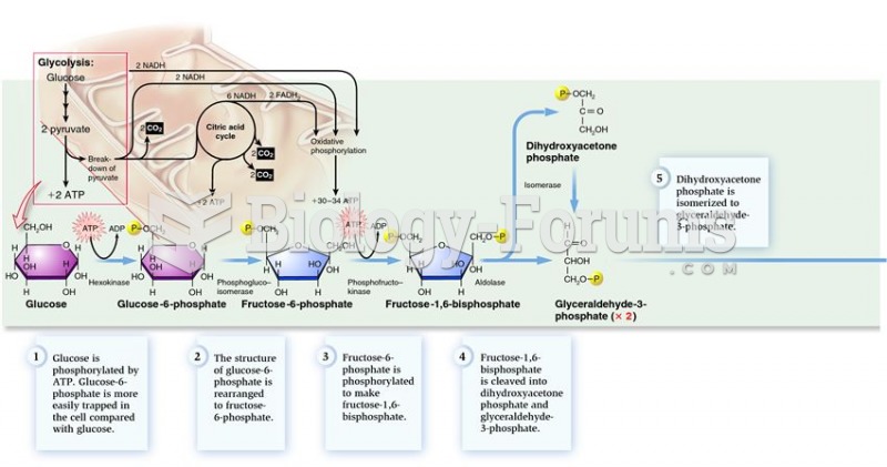 Overview of glycolysis