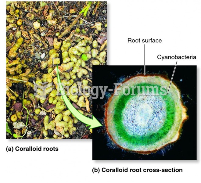 Coralloid roots of cycads.