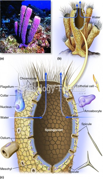 Sponge morphology.