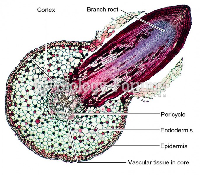 Cross-section of a mature root.