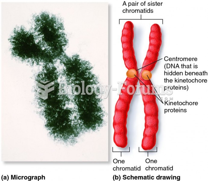 Metaphase chromosomes