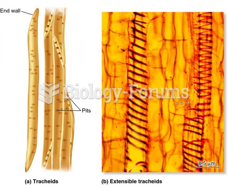 Tracheid cells in xylem tissue.