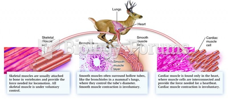 Three types of muscle tissue: skeletal, smooth, and cardiac muscle.