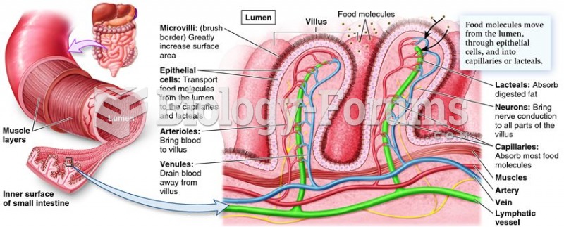 The specialized arrangement of tissues in the small intestine.