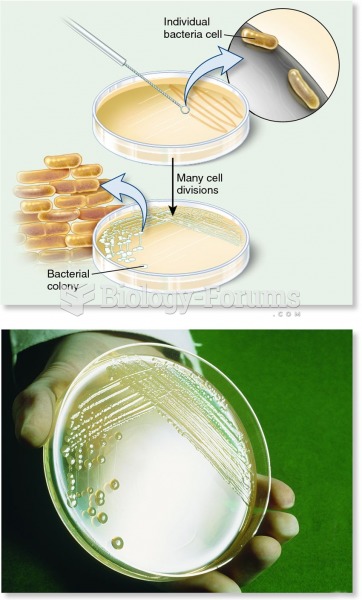 Growth of a bacterial colony.