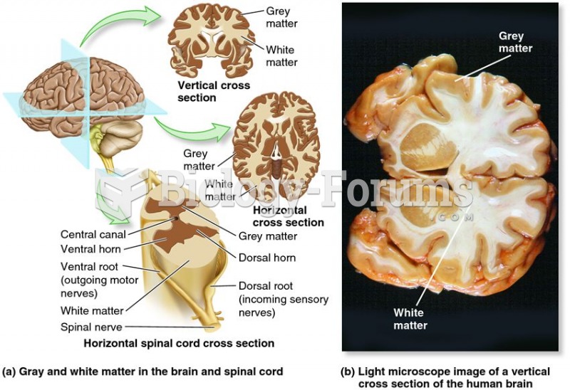 Grey matter and white matter in the CNS.