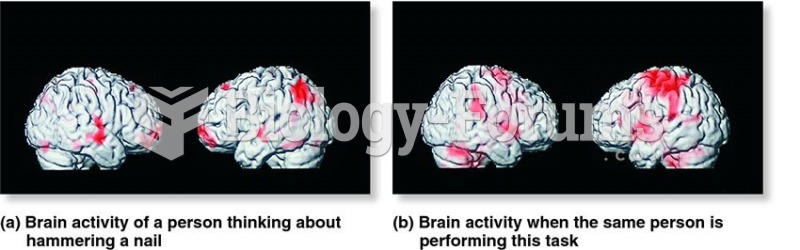 Exploring the functional activity of brain regions by using fMRI scans.