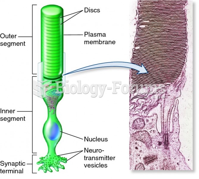Structure of a photoreceptor.