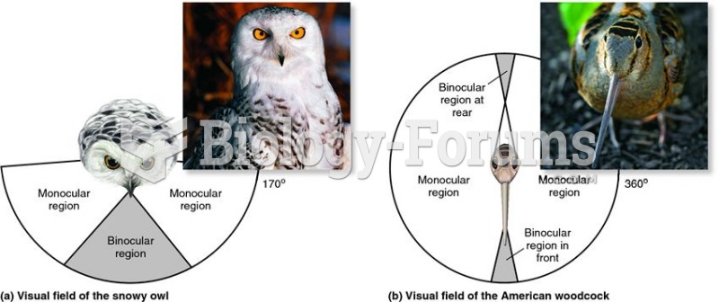 Examples of binocular and monocular fields of vision.