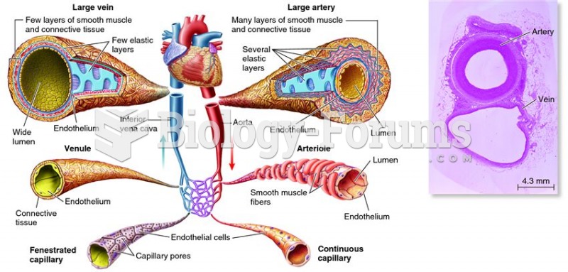 Comparative features of blood vessels.