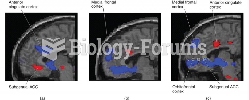 Effects of Deep Brain Stimulation of the Subgenual ACC 